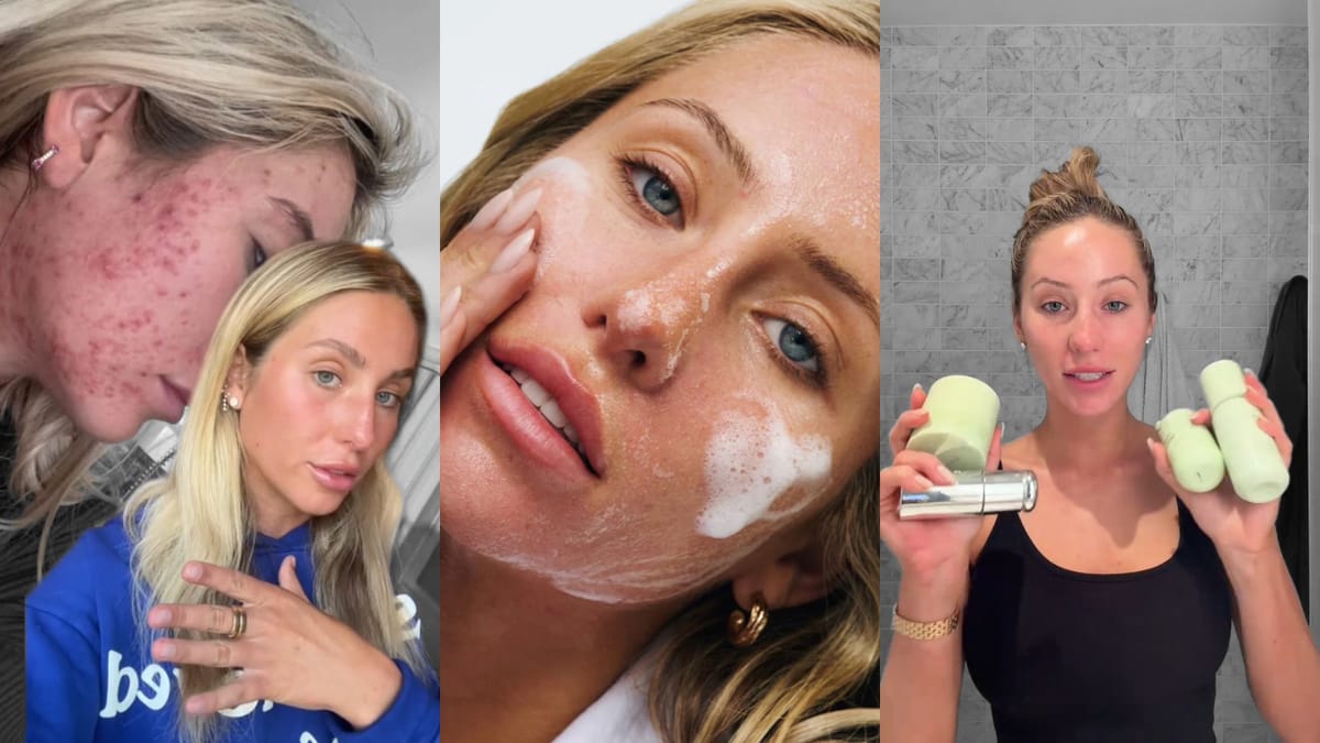 SoFire’s Hot Campaigns: Alix Earle’s Skincare Launch Proves Why Authenticity Always Wins